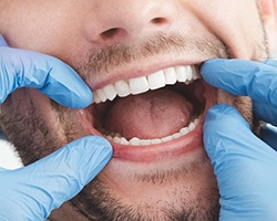 Dentist checks dental implants in Willowbrook